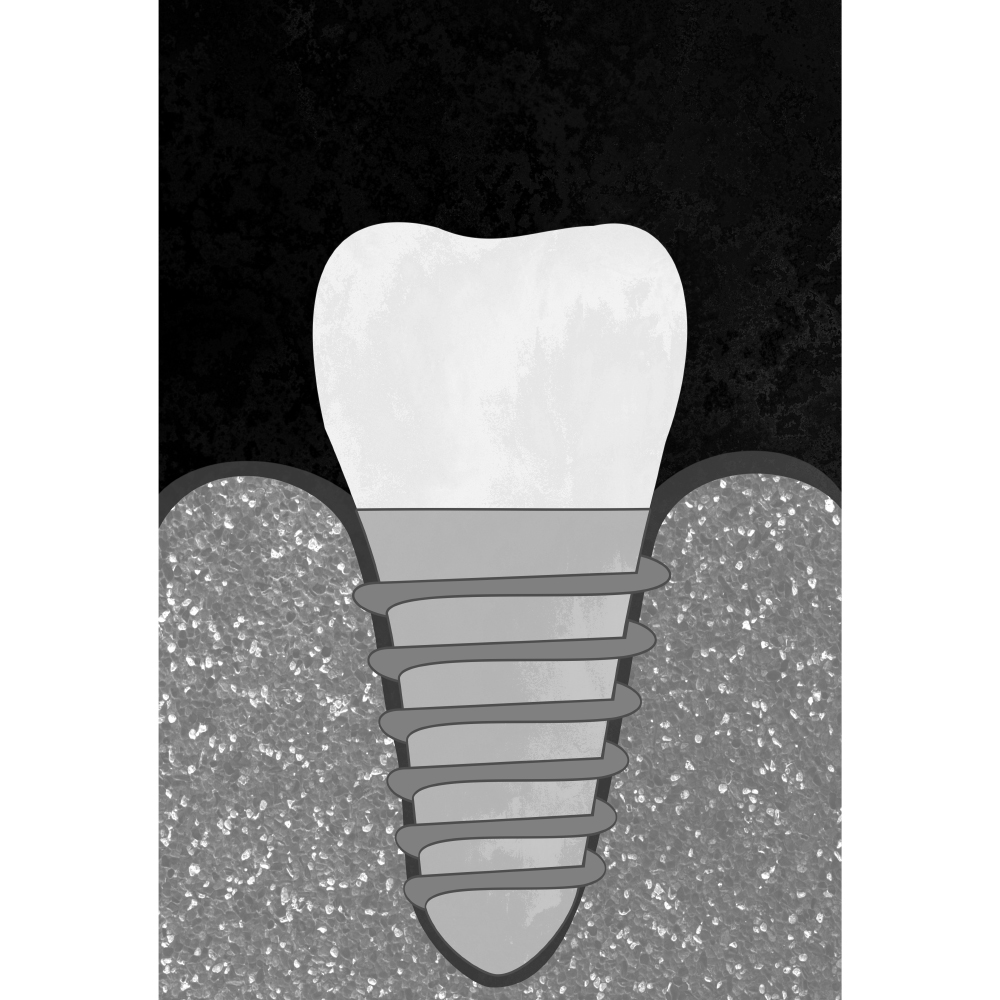 Tela para Quadros Profisso Dentista Implante Dentrio - Afic10962